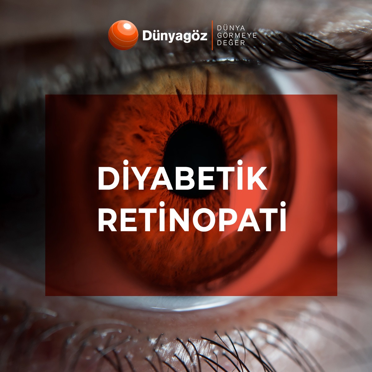 DİYABETİK RETİNOPATİ BROŞÜR